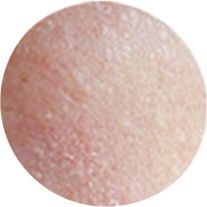 The skin is dehydrated and rough after the operation The skin is dehydrated and rough after the operation