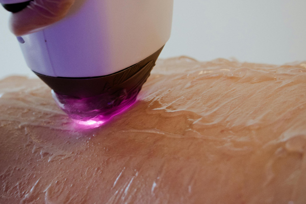 Keeping Pace with the Regulations of the Beauty Industry: Pingchuang Medical Ensures Compliance of photon cold gel Products