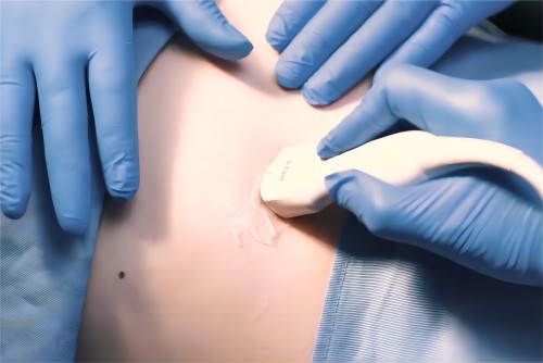 Ultrasound Probes Damaged by Gel? Switch to Safe Medical Ultrasound Gel Ultrasound Probes Damaged by Gel? Switch to Safe Medical Ultrasound Gel